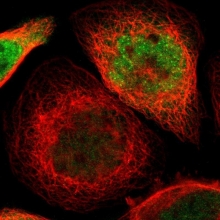 NBP1-81620 - TER ATPase / VCP